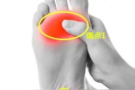 中老年人足底疼痛，为啥反复治不好？请看这3个原因，详细告诉您图片