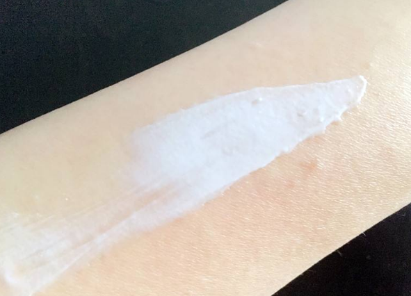 脱毛膏引起毛周角化