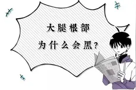为什么个别女生的大腿根部非常黑？图片