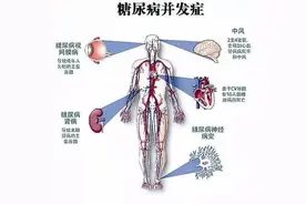 糖尿病与癌症图片