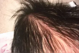 新生儿6种看似奇怪其实正常的现象，顺其自然就好，无需过度关心图片