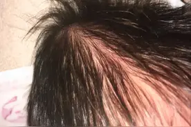 新生儿6种看似奇怪其实正常的现象，顺其自然就好，无需过度关心图片