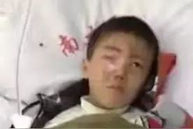 20分钟孩子眼球被溶化！医生说这东西每家都有，家长一定要高度警惕图片