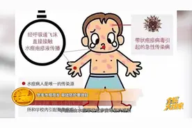冬季水痘高发 基础防护要做好图片