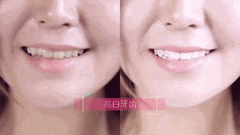 涓€娆惧彿绉?鈥滀笂甯濆垱閫犵殑鐗欒啅鈥?姊呭ゥ鍖婚櫌閮芥槸鎸囧畾瀹?缃戝弸锛氫竾鑳? onerror=