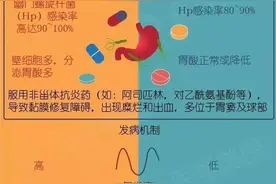 十二指肠溃疡可以自愈吗图片