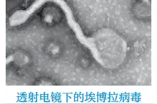 埃博拉疫情再次暴发，被称为自然界最完美的“杀人机器”，网友留言：不吃野味！敬畏自然图片