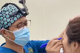 哪种双眼皮手术效果好？图片