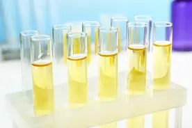 男人晨起“第一泡”，若没有这3个表现，有可能肾脏很强壮图片