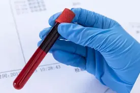 牙医注意！这12种人来拔牙，你得小心了图片