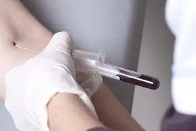 为啥去医院总是要抽血？抽那么多血，最终都到哪里去了？图片