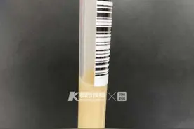 19岁小伙被蛇咬伤治疗，意外发现自己的血竟是乳白色的！和他工作有关图片