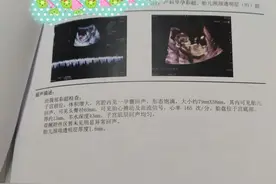 你们有怀孕装空调的吗？怀孕是否能装空调呢？图片