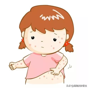 小孩脸上皮肤角化怎么办