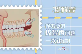 「够科普」不是每一颗智齿都要拔掉！拔智齿注意事项一次讲清图片