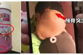 郴州“大头娃娃事件”不止一起！家长曾联名要求处理假奶粉，有医生被停职图片