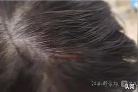 提醒同事戴口罩反被打伤头 女子遭南昌香格里拉大酒店辞退图片
