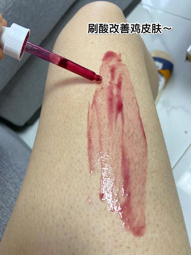 磨砂膏擦鸡皮肤的方法