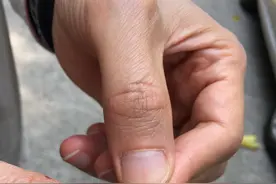 黑色小虫子频繁出没！佛山禅城园林专家出招防治蓟马图片