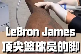 成就越多牺牲越多，传奇的詹姆斯，脚都和普通人不一样图片