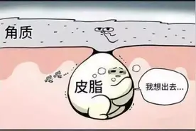 植发术后，明确这3个时间点，才不会把头发“洗掉”图片