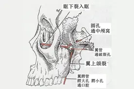 【图文并茂】翼腭窝的CT影像解剖图片