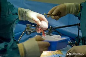 你知道吗，肾移植后，人体内将会有3个肾图片