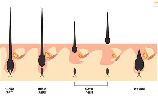 脱毛膏引起毛周角化