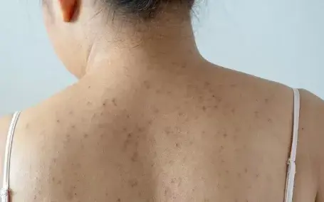 身体乳有点油怎么办
