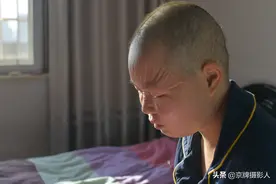  女孩患病皮肤褶皱，翻衣柜发现了妈妈的秘密图片