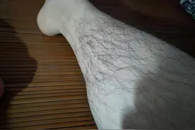 男性腿毛少是身体“发育不良”吗？腿毛旺盛意味着什么？早知早好图片