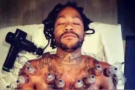 NBA球星对拔火罐多么痴迷？库里情有独钟，罗斯则近乎痴狂图片