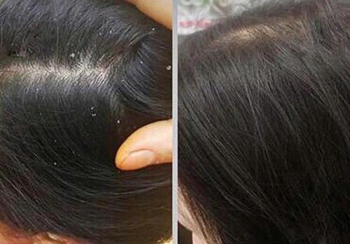 鎴戝浗鈥滈粯榛樻棤闂烩€濈殑娲楀彂姘达紝骞充环鍙堝ソ鐢紝缃戝弸锛氱敤瀹屽ご鍙戞洿濂戒簡