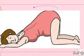 PP痛元凶之臀上皮神经炎图片