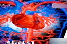 女子运动却不出汗，难道是得了无汗症？也可能是肾阳虚！