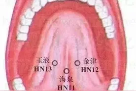 中医望诊窍门（一）：看“龈交穴”就知道你有没“肠息肉”图片