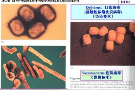 【病毒知识科普】了解病毒的发展史，掌握病毒的特点和结构图片