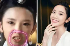 明星整牙惨痛事实：你以为她们为了美丽，其实是为了健康图片