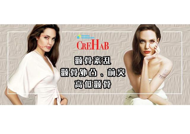 颧骨外凸与高低，两侧颧骨不对称，脸型又太凸，颧骨怎么运动改善