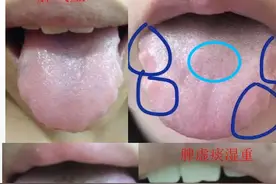 喝粥能改善脾虚吗？脾虚如何快速改善？图片