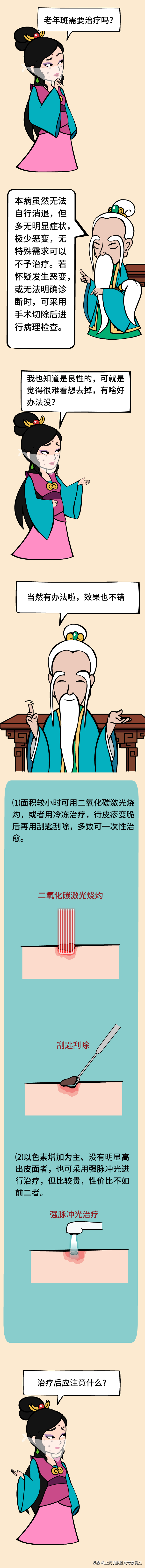 脂溢性角化病治疗药物