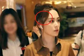 阿娇伤后光速复工，缝66针的脸部疤痕凭空消失？魔幻手法...图片