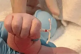 关于“上环、取环”的那些事儿，要注意啦！图片