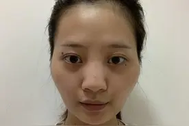 3年时间花了10万去整容！把自己整成这样，值得吗？图片
