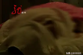 父亲的头皮，被成功移植到了女儿身上！小姑娘哭了：对不起爸爸图片