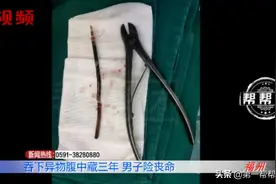 男子腹痛难忍，罪魁祸首竟是三年前吞下的一根笔芯？图片