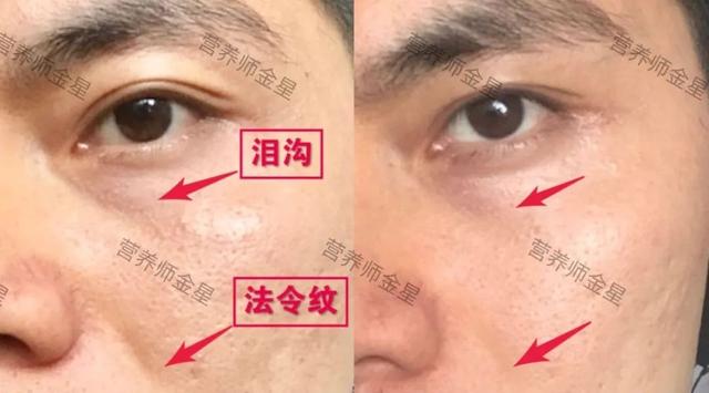 胶原蛋白是“智商税”吗？我不这么认为