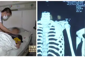 12岁男孩锁骨处长包块，以为是外伤，检查结果让医生大惊失色