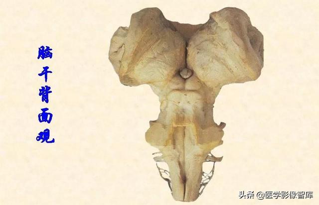 脑干、小脑及间脑解剖