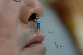 人到中年，鼻毛为何窜出来？鼻毛旺盛说明什么？看完涨知识了图片